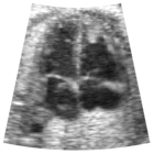 a. Original ultrasound image.